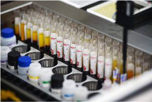 Blood is tested for infection (hepatitis, syphilis, HIV). Alexandr Kryazhev/Sputnik via AP Credit: AP