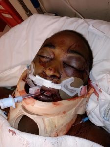 Damien Cameron’s family photographed him in the hospital shortly before he died from the injuries he sustained during his arrest by Rankin County deputies. Credit: Courtesy of Damien Cameron's family