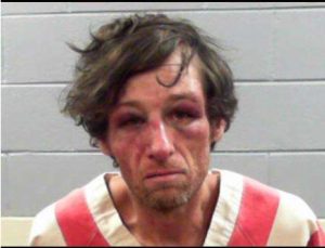Mr. Paige’s booking photo, taken at the Rankin County jail in 2018, shows his battered and bruised face after an encounter with deputies. Photo Credit: Rankin County Sheriff's Office