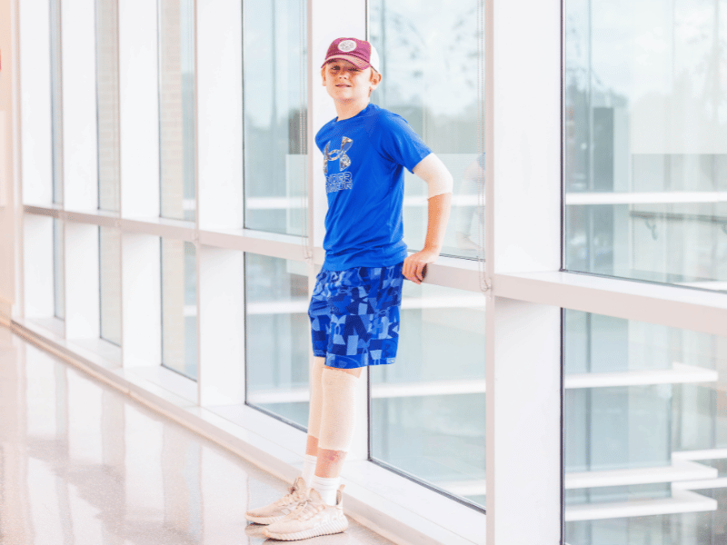 Indomitable spirit, skilled care aids healing in Mississippi Burn Center patient